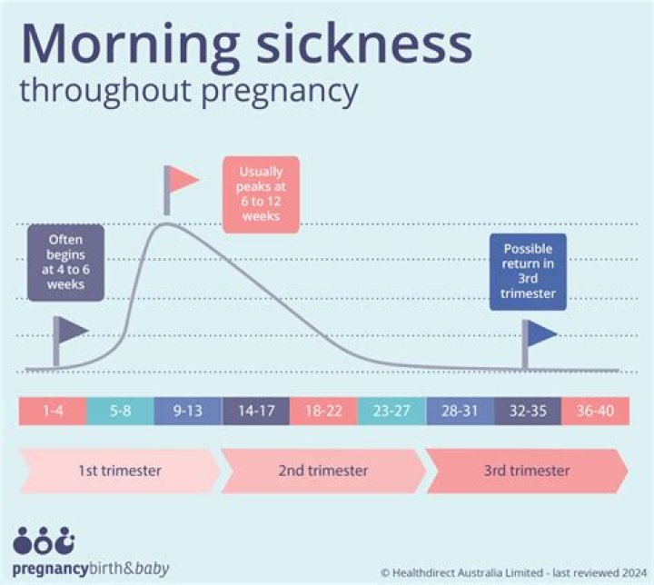 Am I having a boy if I don't have morning sickness?
