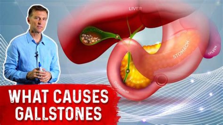 Are gallstones fatal?