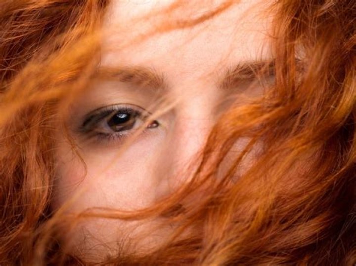 Are redheads more sensitive emotionally?