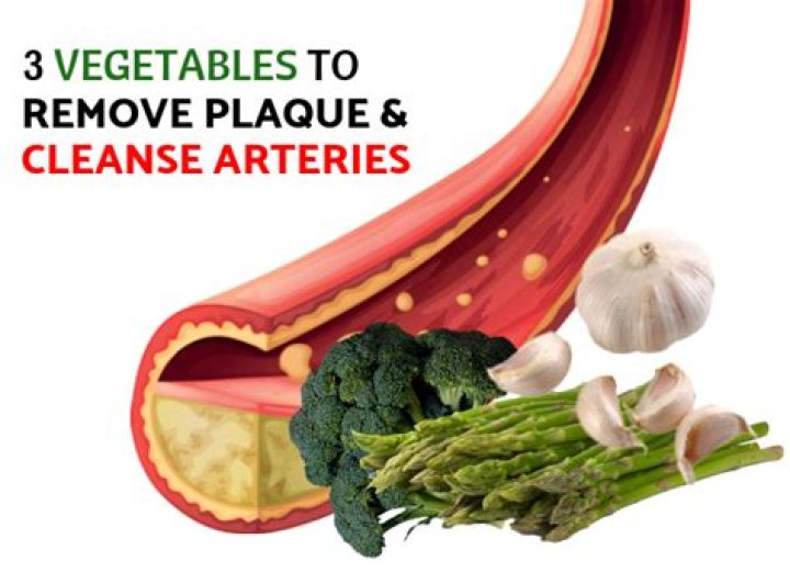 Are there foods that dissolve artery plaque?