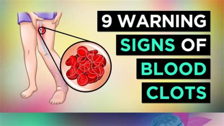 Are there warning signs of blood clots?