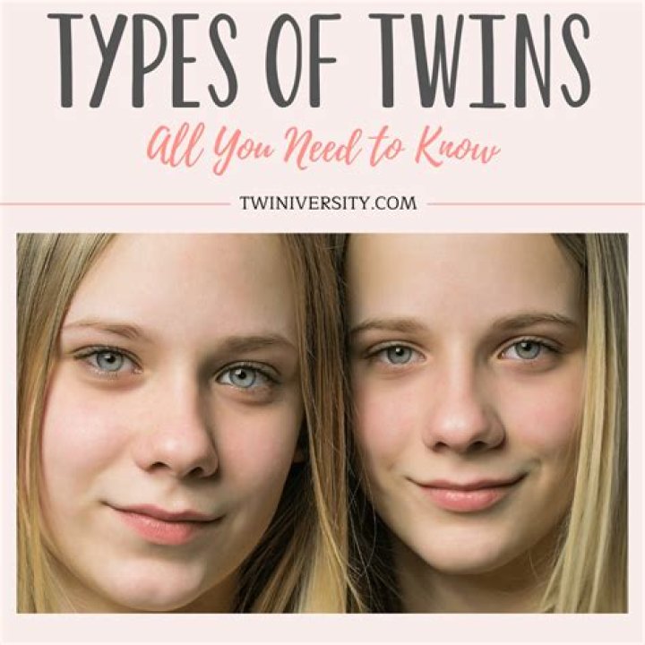 Are twins common or rare?