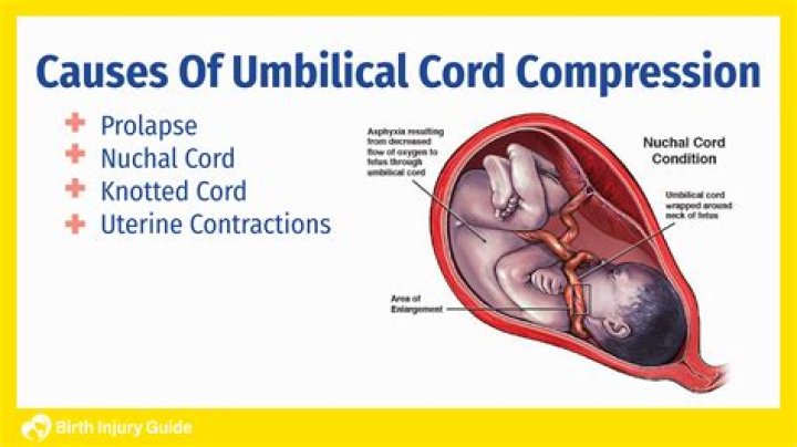 Can a baby survive without an umbilical cord?
