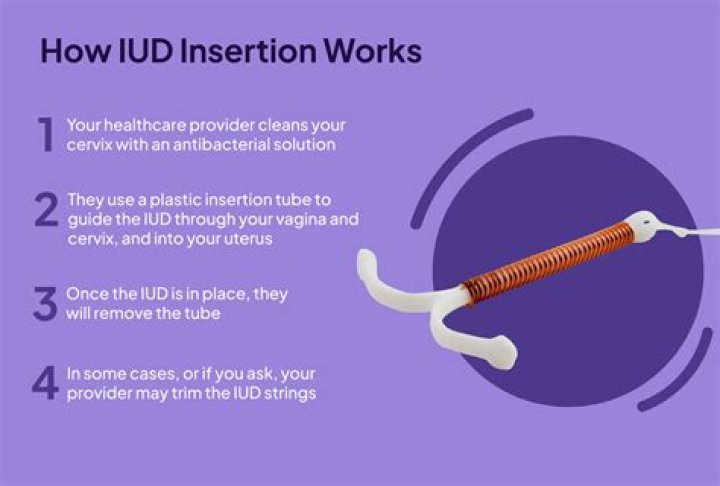 Can a guy finish in you with an IUD?