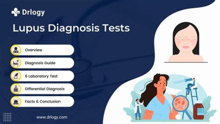 Can a neurologist diagnose lupus?
