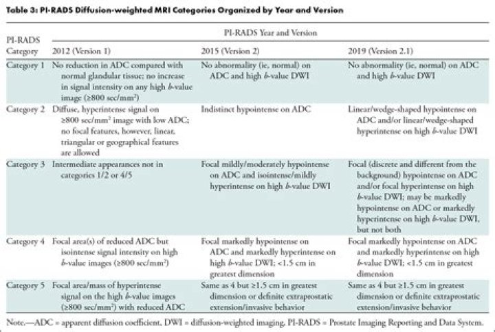 Can a PI RADS 4 prostate lesion be benign?
