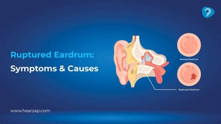 Can a ruptured eardrum cause permanent hearing loss?
