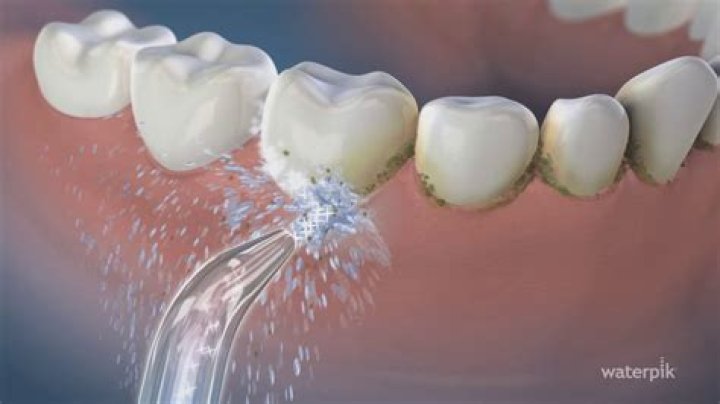 Can a Waterpik damage your gums?