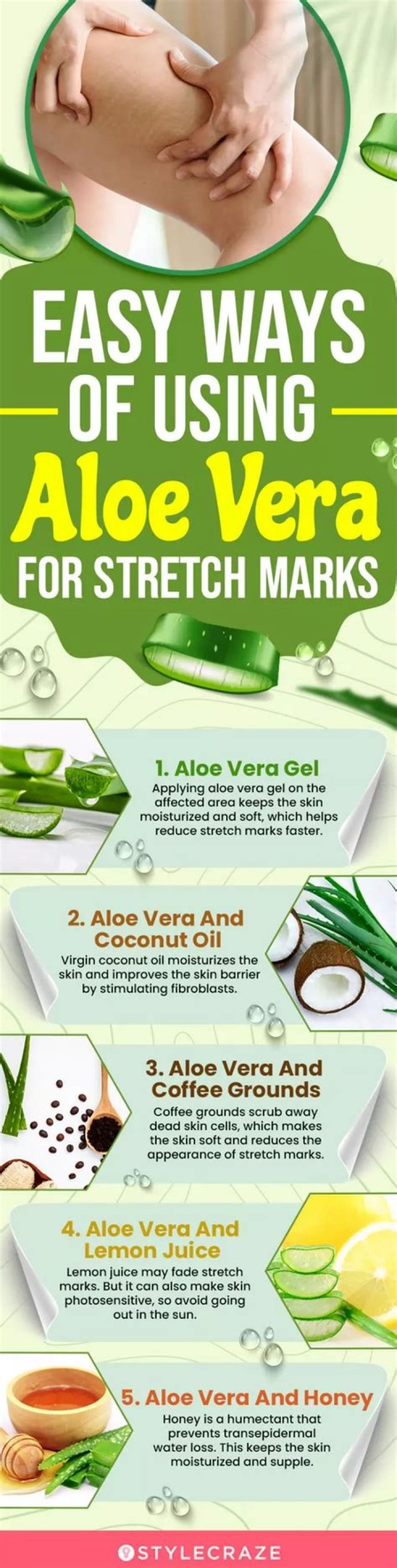 Can aloe vera clear stretch marks?
