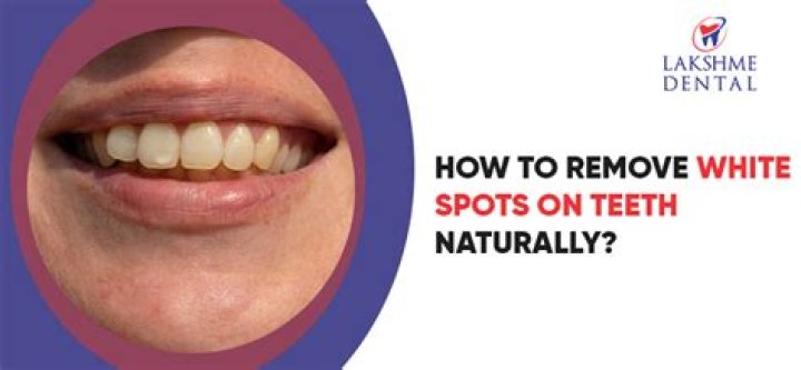 Can aloe vera remove white spots?