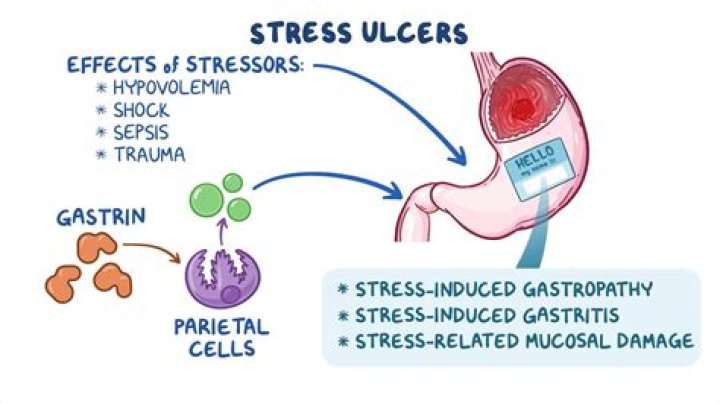 Can ALS be caused by stress?