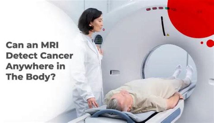 Can an MRI detect nerve damage in ear?