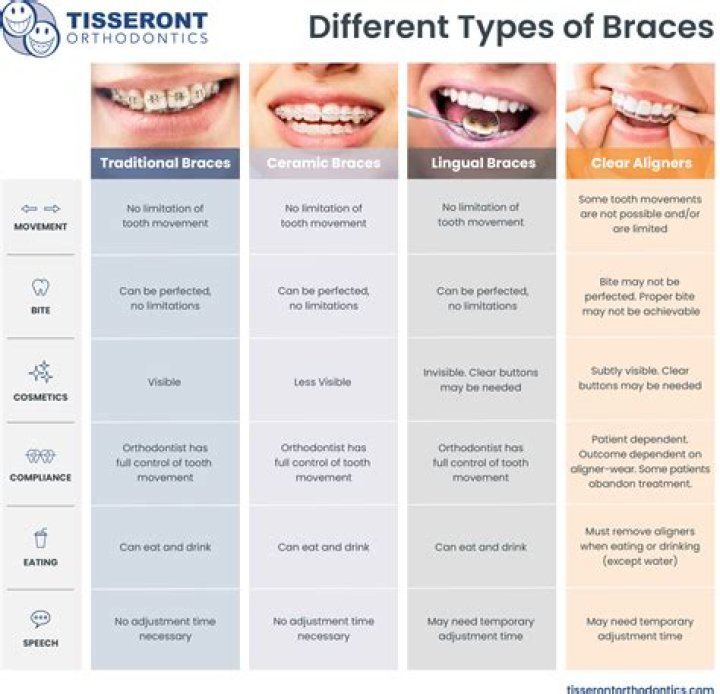 Can braces be left on too long?