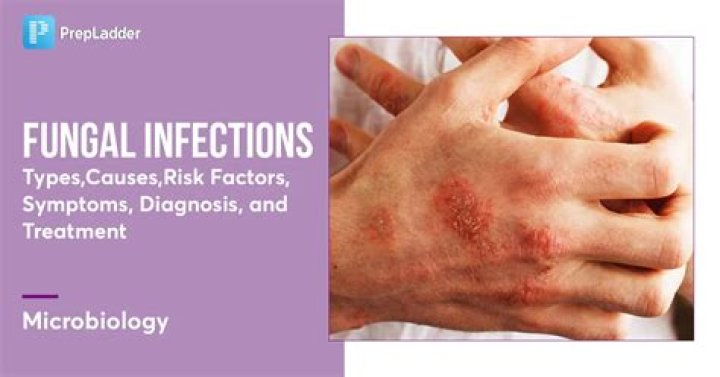 Can COVID-19 cause fungal infections?