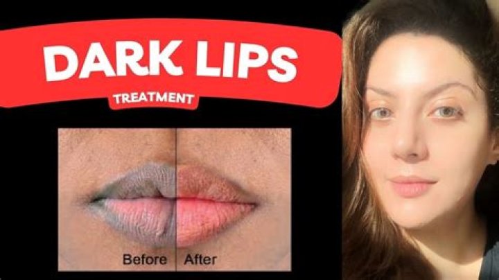 Can cucumber remove dark lips?
