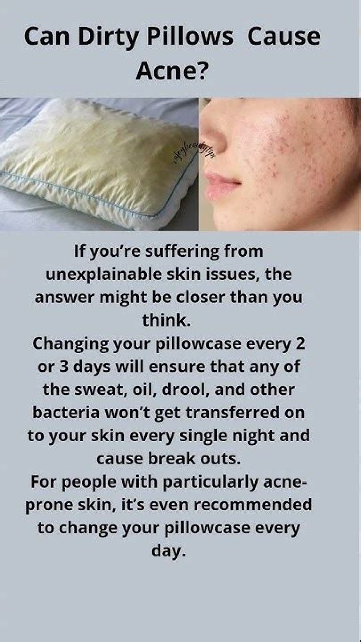 Can dirty pillows cause acne?