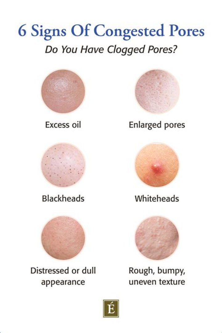 Can emu oil clog pores?