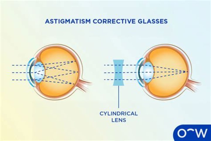Can glasses fix astigmatism?