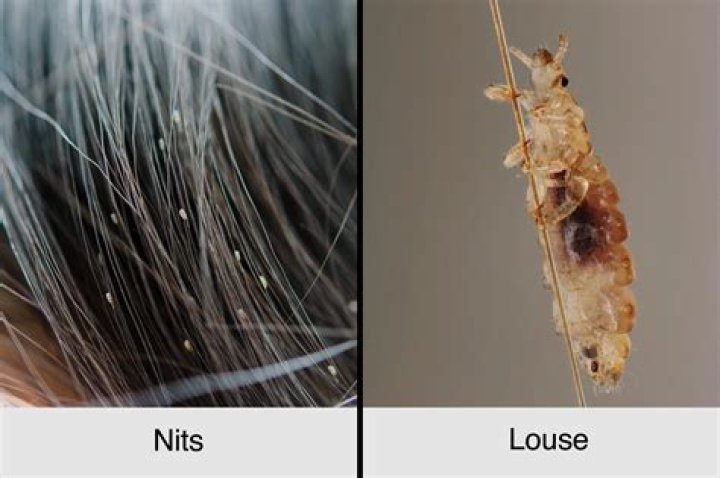 Can head lice turn into body lice?