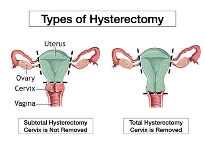Can HPV come back after hysterectomy?