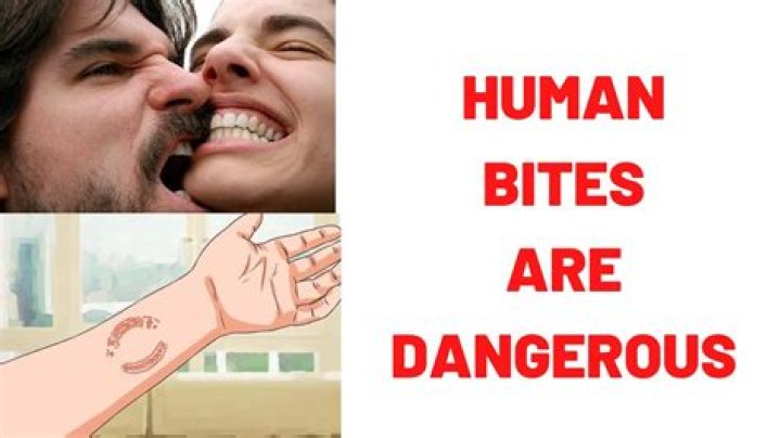 Can humans bite through bone?