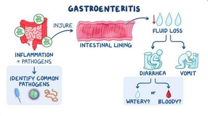 Can I drink milk with gastroenteritis?