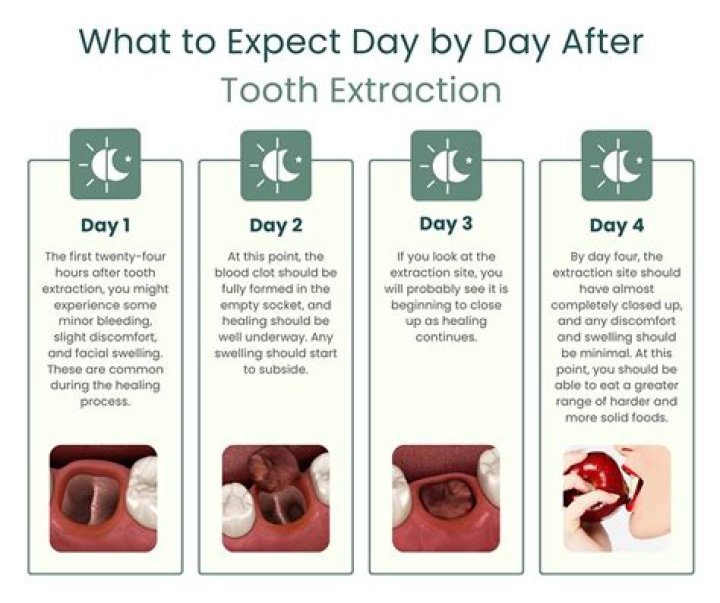 Can I eat tuna after tooth extraction?
