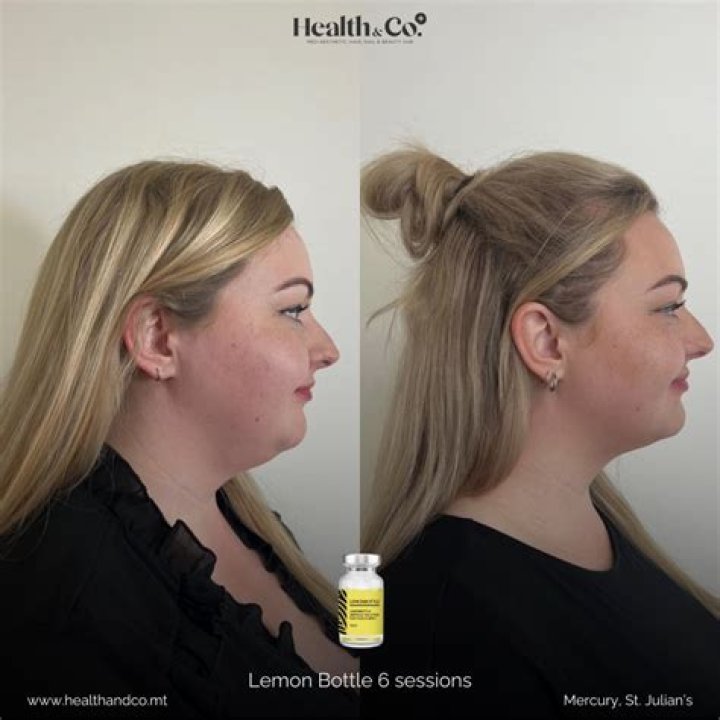 Can I mix lemon with my body cream?