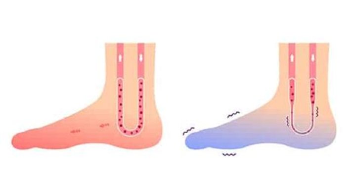 Can lying down too much cause poor circulation?
