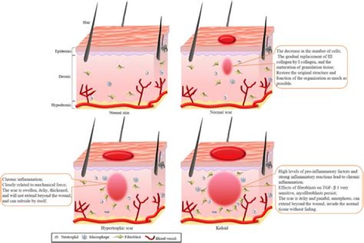 Can nerves regrow?