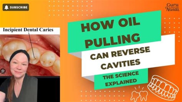Can oil pulling cause cavities?