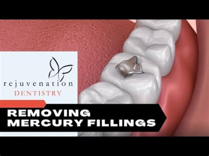 Can old tooth fillings make you sick?