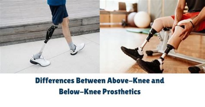 Can shorts go below the knee?
