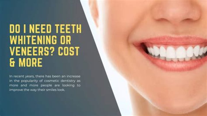 Can some teeth not be whitened?