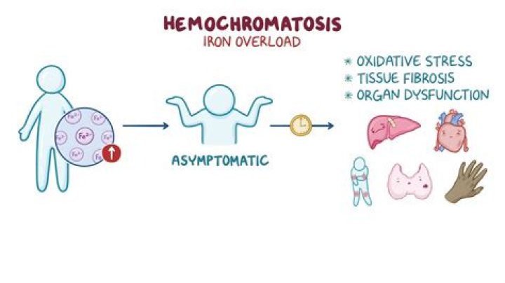 Can someone with haemochromatosis donate blood?