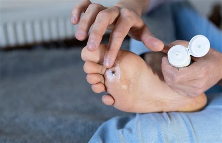 Can taking collagen cause plantar fibroma?