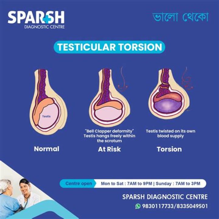 Can testicular torsion fix itself?