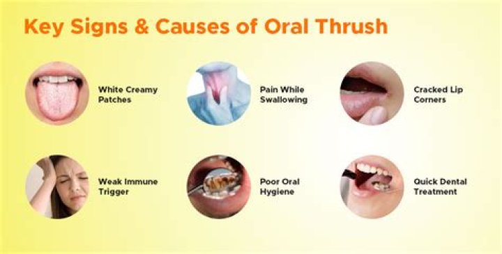 Can thrush cause bleeding when wiping?