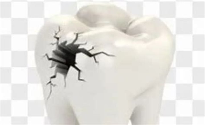 Can tiny cavities go away?
