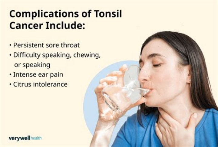 Can tonsils become cancerous?