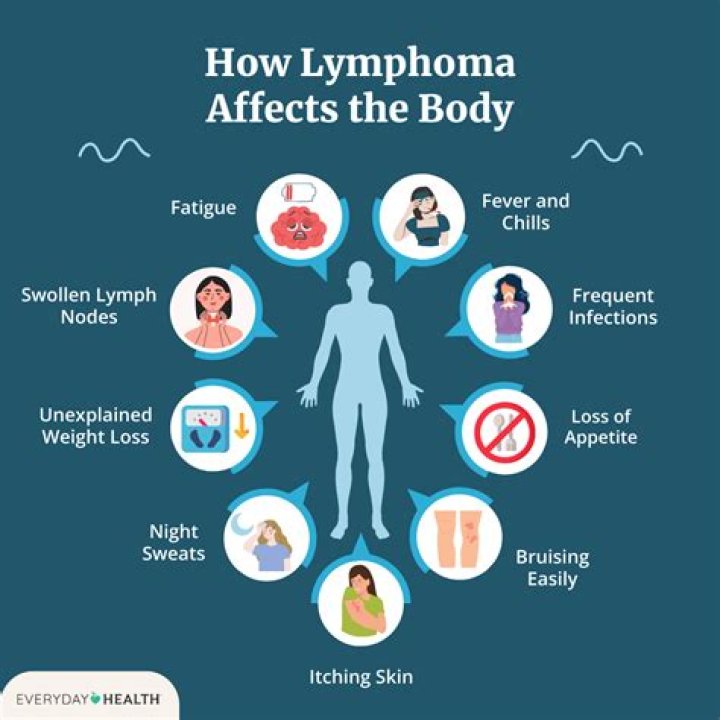 Can you have lymphoma and gain weight?