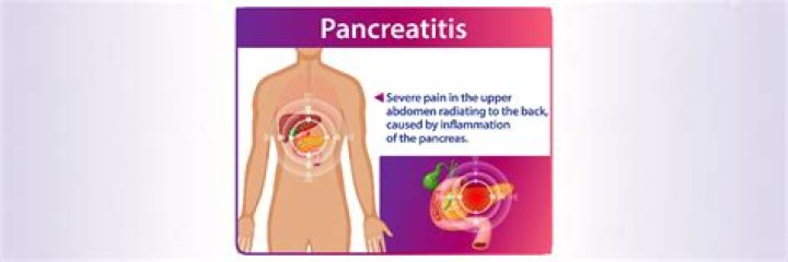 Can you ignore pancreatitis?