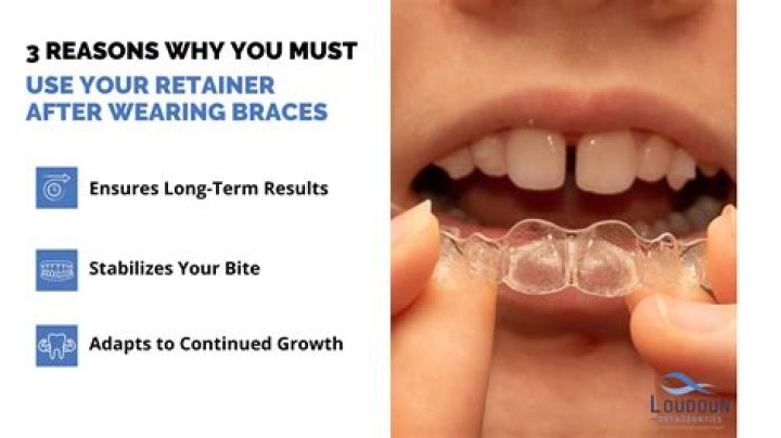 Can you keep your braces on forever?