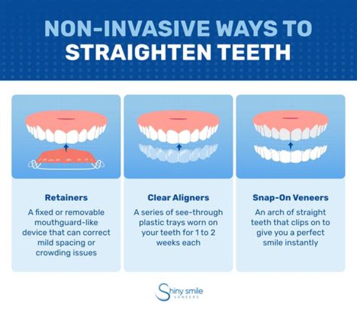 Can you straighten teeth with your tongue?