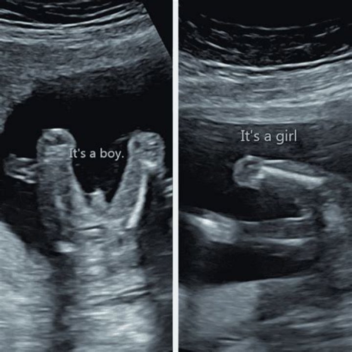 Can you tell if a baby is black from an ultrasound?