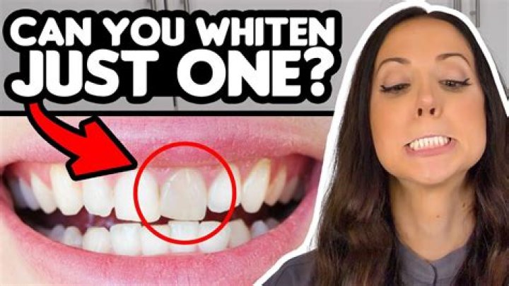 Can you whiten a veneer tooth?
