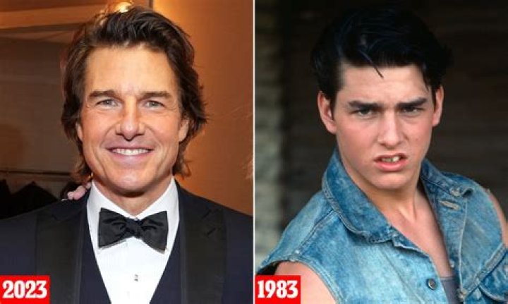 Did Daniel from Return to Amish get his teeth fixed?