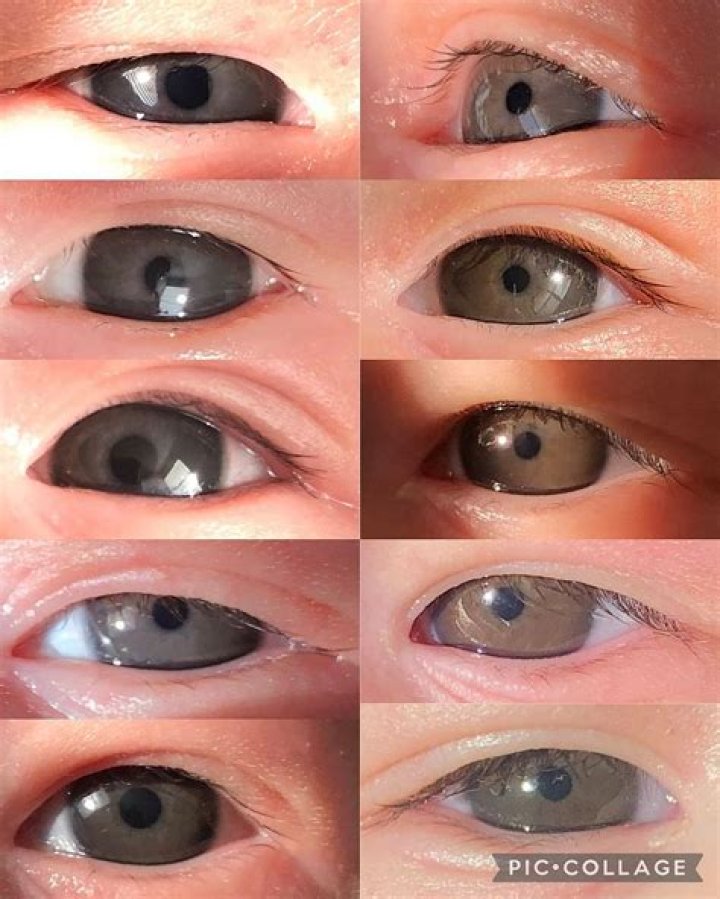 Do black babies have blue eyes?