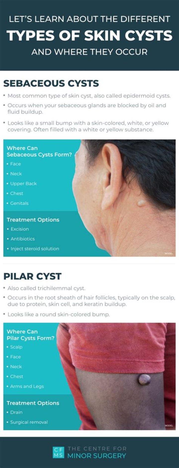 Do cysts grow bigger?