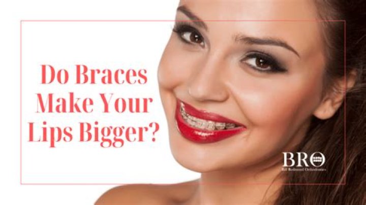 Do dentures make your lips bigger?